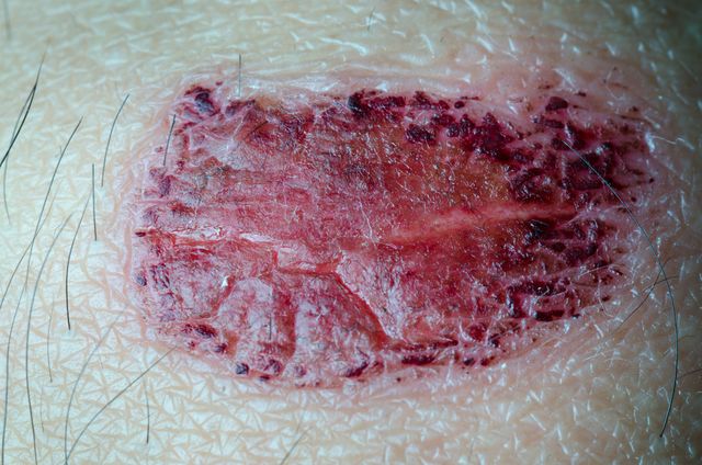 Zdroj: Shutterstock.com