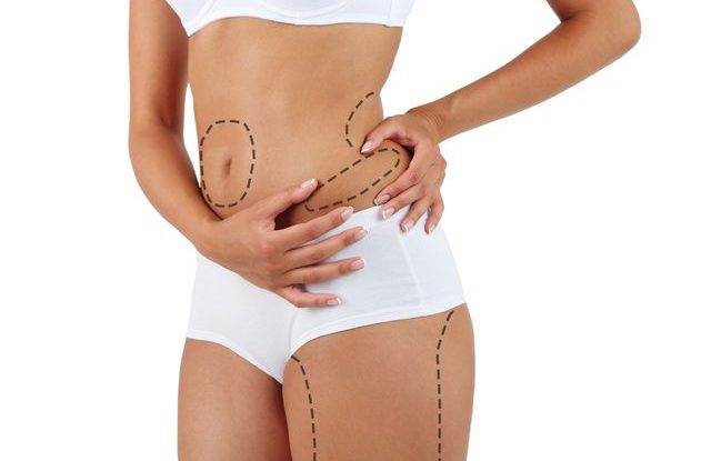 liposukce