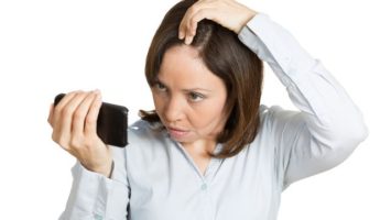Alopecie, padání vlasů u žen