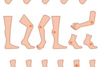 Nejčastější místa výskytu dny