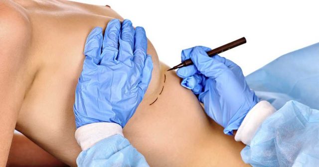 Plastická operace prsou Esthé