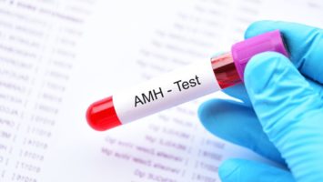 AMH test
