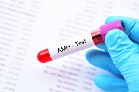 AMH test