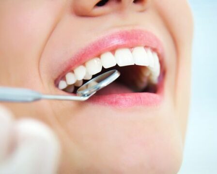 perfektně vyčištěné zuby sonické zubní kartáčky zubař