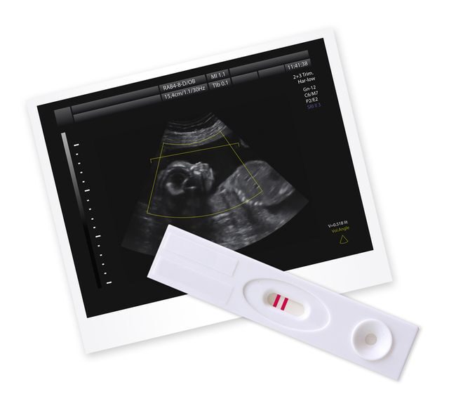 tehotensky-test-ultrazvuk-tehotenstvi