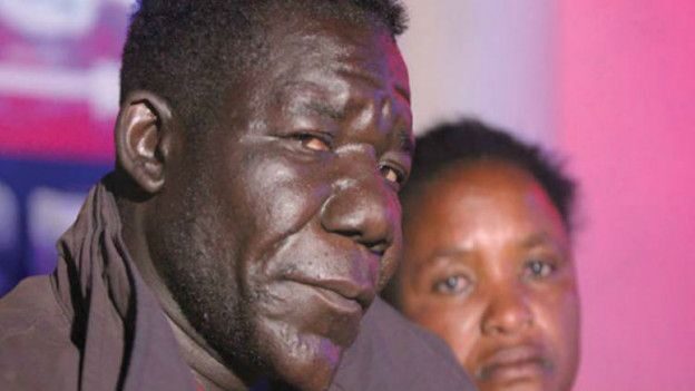 Nejošklivější muž světa William Masvinu