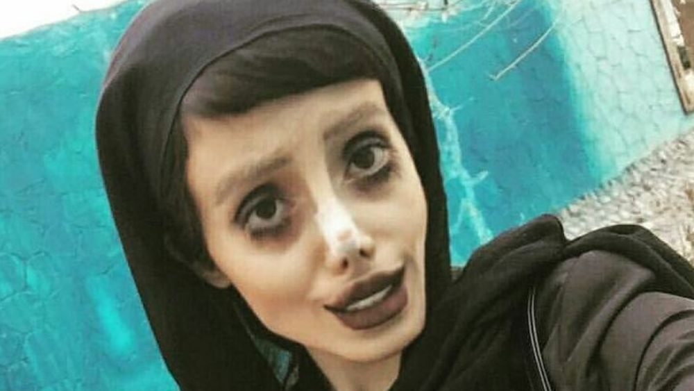 Žena podstoupila 50 operací, aby vypadala jako Angelina Jolie