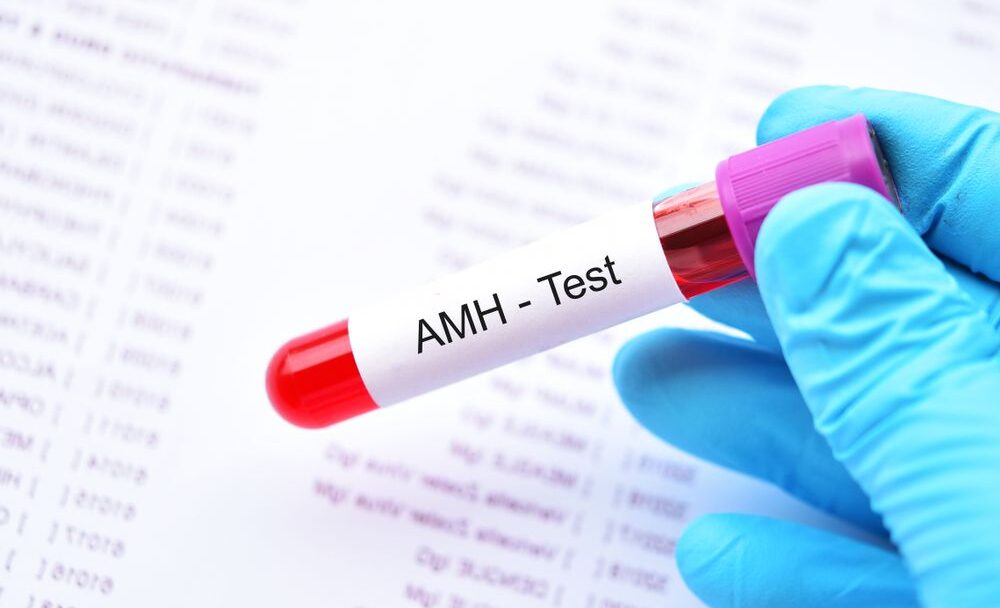 AMH test